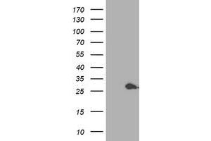 Western Blotting (WB) image for anti-Proteasome (Prosome, Macropain) Subunit, beta Type, 4 (PSMB4) antibody (ABIN1500472) (PSMB4 Antikörper)