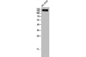 Western Blot analysis of SH-SY5Y cells using Laminin γ-3 Polyclonal Antibody (LAMC3 Antikörper  (C-Term))