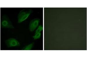 Immunofluorescence analysis of HeLa cells, using Lck (Ab-505) Antibody. (LCK Antikörper  (AA 460-509))