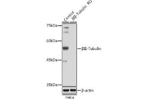 Western blot analysis of extracts from normal (control) and βIII-Tubulin/β3-Tubulin Rabbit pAb knockout (KO) HeLa cells, using βIII-Tubulin/β3-Tubulin Rabbit pAb antibody (ABIN7271048) at 1:1000 dilution. (TUBB3 Antikörper)
