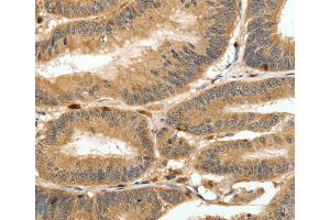 Immunohistochemistry (IHC) image for anti-S100 Calcium Binding Protein A4 (S100A4) antibody (ABIN2426858) (s100a4 Antikörper)