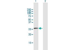 Western Blot analysis of IGKV1-5 expression in transfected 293T cell line by IGKV1-5 MaxPab polyclonal antibody. (IGKV1-5 Antikörper  (AA 1-235))