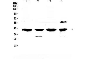 Western blot analysis of VEGFD using anti-VEGFD antibody . (VEGFD Antikörper  (AA 89-205))
