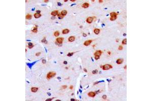 Immunohistochemical analysis of DUSP16 staining in human brain formalin fixed paraffin embedded tissue section.