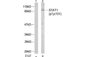 Image no. 2 for anti-Signal Transducer and Activator of Transcription 1, 91kDa (STAT1) (pTyr701) antibody (ABIN196689) (STAT1 Antikörper  (pTyr701))