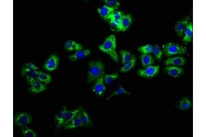 Immunofluorescence staining of HepG2 cells with ABIN7157950 at 1:166, counter-stained with DAPI. (LIME Antikörper  (AA 170-295))