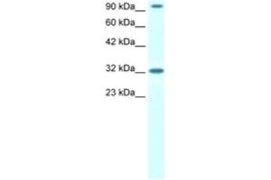 Western Blotting (WB) image for anti-CIon Channel antibody (ABIN2460486) (CIon Channel Antikörper)