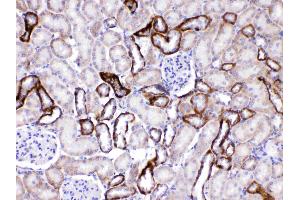Immunohistochemistry (IHC) image for anti-Glutamate Decarboxylase 2 (Pancreatic Islets and Brain, 65kDa) (GAD2) (AA 131-164), (N-Term) antibody (ABIN5518755)