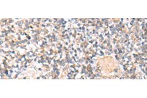 Immunohistochemistry of paraffin-embedded Human tonsil tissue using IL36A Polyclonal Antibody at dilution of 1:30(x200) (IL36A/IL1F6 Antikörper)