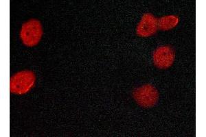 ABIN6269080 staining MCF-7 cells by ICC/IF. (Estrogen Receptor alpha Antikörper  (C-Term))