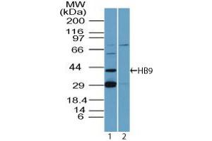 Image no. 2 for anti-Motor Neuron and Pancreas Homeobox 1 (MNX1) (AA 330-380) antibody (ABIN960266)