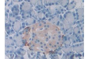 DAB staining on IHC-P; Samples: Rat Pancreas Tissue (SLIT1 Antikörper  (AA 611-791))