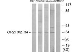 Western blot analysis of extracts from MCF-7/HuvEc/HeLa/HepG2 cells, using OR2T3/2T34 Antibody. (OR2T3/2T34 (AA 269-318) Antikörper)