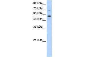 WB Suggested Anti-ZNF71 Antibody Titration:  0. (ZNF71 Antikörper  (N-Term))