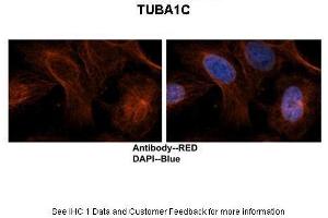 Sample Type: Human brain stem cells Primary Antibody Dilution: 1:500Secondary Antibody: Goat anti-rabbit Alexa-Fluor 594 Secondary Antibody Dilution: 1:0000Color/Signal Descriptions: TUBA1C: Red DAPI: Blue  Gene Name: TUBA1C Submitted by: Dr.