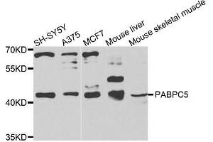 Western blot analysis of extracts of various cell lines, using PABPC5 antibody (ABIN6003706) at 1/1000 dilution. (PABPC5 Antikörper)