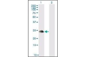 Western Blotting (WB) image for anti-TSC22 Domain Family, Member 3 (TSC22D3) (AA 1-98) antibody (ABIN614600) (TSC22D3 Antikörper  (AA 1-98))