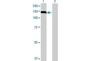 Western Blot analysis of UTP14A expression in transfected 293T cell line by UTP14A MaxPab polyclonal antibody. (UTP14A Antikörper  (AA 1-771))