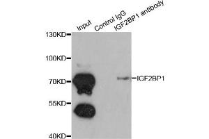 Immunoprecipitation analysis of 200ug extracts of K562 cells using 1ug IGF2BP1 antibody (ABIN6293020).