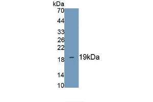 Detection of Recombinant LPCAT3, Mouse using Polyclonal Antibody to Lysophosphatidylcholine Acyltransferase 3 (LPCAT3) (LPCAT3 Antikörper)