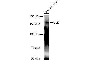 Western blot analysis of extracts of Mouse brain, using ULK1 antibody (ABIN6134005, ABIN6149921, ABIN6149922 and ABIN6224624) at 1:1000 dilution. (ULK1 Antikörper  (AA 400-499))