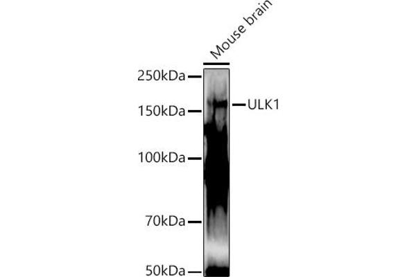ULK1 anticorps  (AA 400-499)