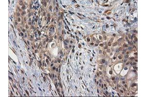 Image no. 3 for anti-Destrin (Actin Depolymerizing Factor) (DSTN) antibody (ABIN1497910) (Destrin Antikörper)