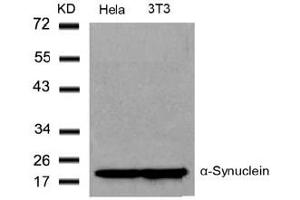 Image no. 2 for anti-Synuclein, alpha (SNCA) (Tyr136) antibody (ABIN319340) (SNCA Antikörper  (Tyr136))