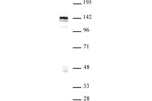 Western blot of BRD8 / SMAP2 antibody. (BRD8 Antikörper  (N-Term))