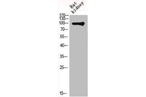 Western Blot analysis of RAT-KIDNEY cells using mGluR-4 Polyclonal Antibody (Metabotropic Glutamate Receptor 4 Antikörper  (C-Term))