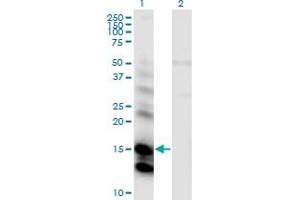 Western Blot analysis of CST6 expression in transfected 293T cell line by CST6 monoclonal antibody (M01), clone 2H8. (CST6 Antikörper  (AA 29-149))