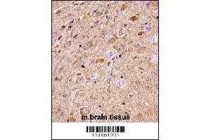 Mouse Nlk Antibody immunohistochemistry analysis in formalin fixed and paraffin embedded mouse brain tissue followed by peroxidase conjugation of the secondary antibody and DAB staining. (Nemo-Like Kinase Antikörper  (C-Term))