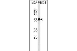 Western blot analysis in MDA-MB435 cell line lysates (35ug/lane). (ASB4 Antikörper  (C-Term))