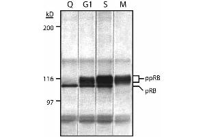 Cell cycle expression of retinoblastoma proteins (Rb) in MOLT-4 human leukemia cell line expressing Rb. (Retinoblastoma 1 Antikörper  (AA 332-344))