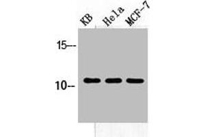 Western Blot analysis of KB HELA MCF-7 cells using SDF-1 Polyclonal Antibody (CXCL12 Antikörper  (C-Term))