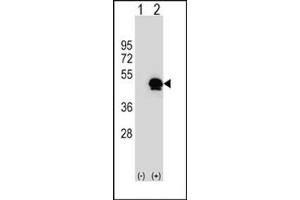 Western blot analysis of SERPINE1 (arrow) using SERPINE1 Antibody (Center) Cat. (PAI1 Antikörper  (Middle Region))