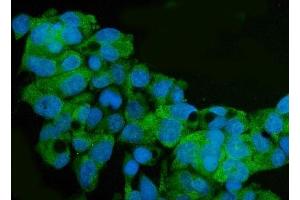 anti-Arginase, Type II (ARG2) (AA 43-320) antibody