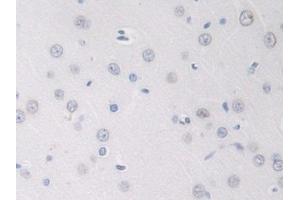 Detection of GDNF in Rat Cerebrum Tissue using Polyclonal Antibody to Glial Cell Line Derived Neurotrophic Factor (GDNF) (GDNF Antikörper  (AA 78-211))