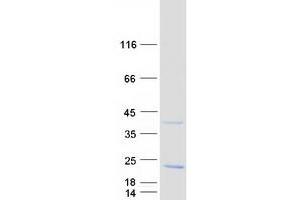 Validation with Western Blot