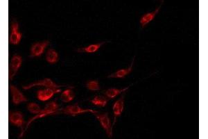 ABIN6275044 staining A549 by IF/ICC. (CST11 Antikörper  (Internal Region))