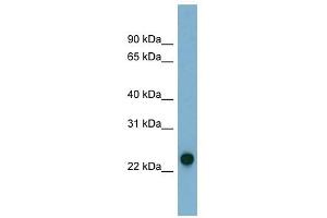AK3 antibody used at 1 ug/ml to detect target protein. (Adenylate Kinase 3 Antikörper  (N-Term))