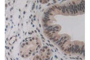 Immunohistochemistry (IHC) image for anti-Endoglin (ENG) (AA 27-137) antibody (ABIN7432973)