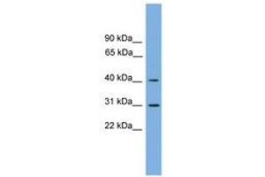 Image no. 1 for anti-Hydroxy-delta-5-Steroid Dehydrogenase, 3 beta- and Steroid delta-Isomerase 7 (HSD3B7) (AA 107-156) antibody (ABIN6744871) (HSD3B7 Antikörper  (AA 107-156))