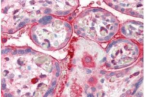 Human Placenta (formalin-fixed, paraffin-embedded) stained with CENTA2 antibody ABIN337009 at 5 ug/ml followed by biotinylated anti-goat IgG secondary antibody ABIN481715, alkaline phosphatase-streptavidin and chromogen. (ADAP2 Antikörper  (AA 375-387))