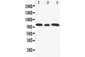 Anti-Gli3 antibody, Western blotting Lane 1: Rat Testis Tissue Lysate Lane 2: A549 Cell Lysate Lane 3: SW620 Cell Lysate