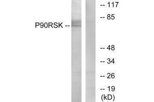 Western blot analysis of extracts from 3T3 cells, treated with PMA (125 ng/mL, 30 mins), using p90 RSK (Ab-573) antibody. (RPS6KA1 Antikörper  (Thr573))