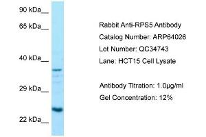 Western Blotting (WB) image for anti-Ribosomal Protein S5 (RPS5) (C-Term) antibody (ABIN971632)