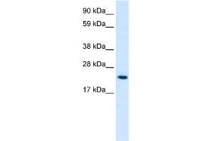 WB Suggested Anti-HMGB3 Antibody Titration:  0. (HMGB3 Antikörper  (C-Term))