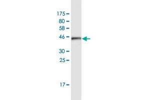 Western Blot detection against Immunogen (42. (ATXN7L1 Antikörper  (AA 1-146))