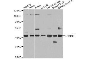 Western blot analysis of extracts of various cell lines, using TARDBP antibody (ABIN6290985) at 1:1000 dilution. (TARDBP Antikörper)